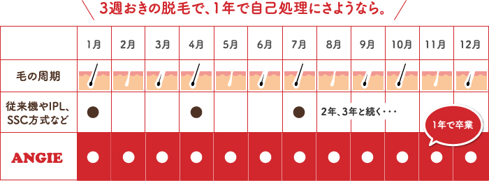 ３週おき脱毛で、１年でさようなら。